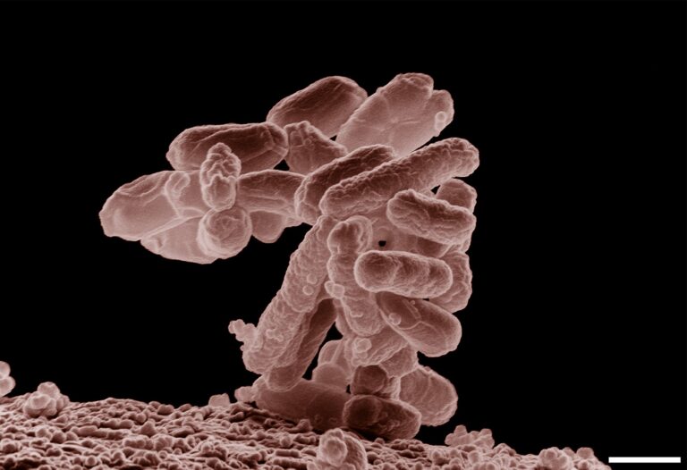 E Coli At 10000x 1 768x526