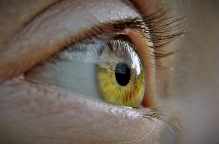 Eye 4721699 1280 768x506 (1)